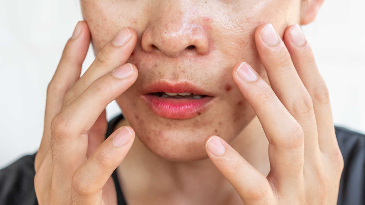 oil skin of a lady
